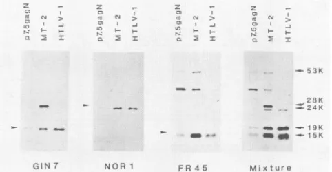 FIG.1.constructionandoutlined.codingHTLV-I_, Schematic representation of the HTLV-1 genome and of p7.5gagN