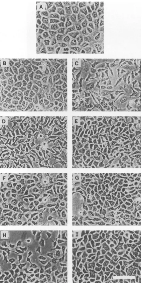 FIG.1.with(B)Ra-2;maintenance Phase-contrast micrographs of 64-24 cells transfected SV40, polyomavirus, v-myc, and H-ras oncogenes