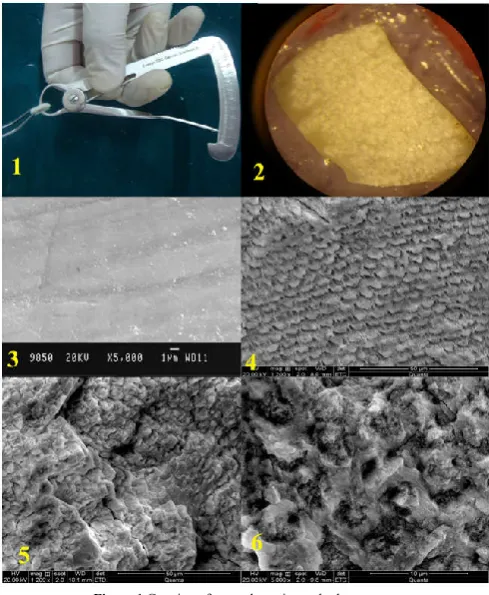 Figure 1 Gauging of enamel specimens by bur gauge 