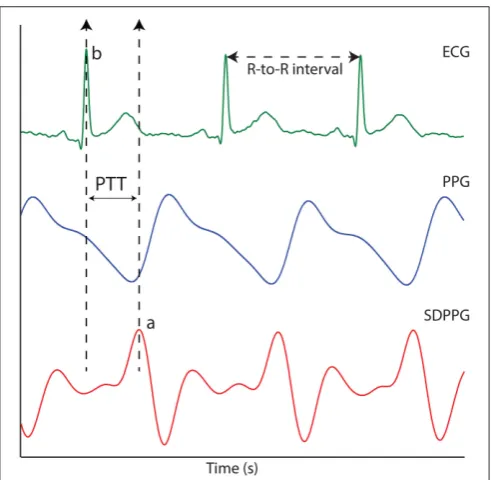 FIGURE 1 | The ECG signal, the PPG signal and the second derivativephotoplethysmographic (SDPPG)