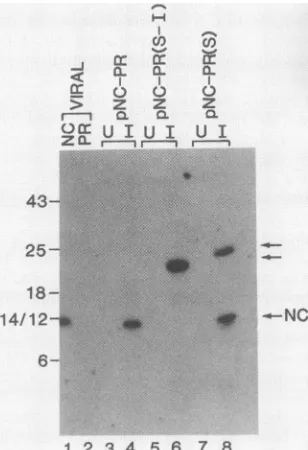 FIG. 2.4),cultures(B)sodiumserum1251I-labeled Immunoblot analysis of PR and NC products expressed in E