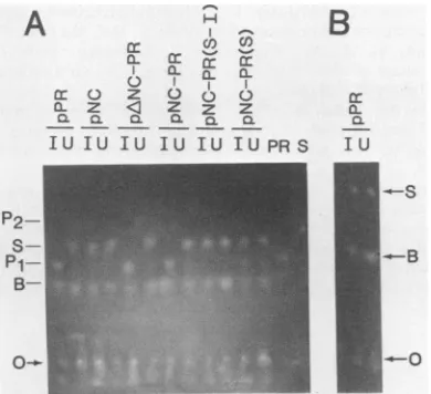 FIG. 4.usingcontaining(lanesbatedpeptidesitescontainingextracts,sis(S),theofispentapeptide(seethestaininglight.uctselsewhere a Detection of PR-specific activity in bacterial extracts bya thin-layer electrophoresisassay