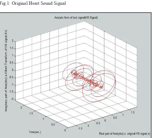 Fig.1: Original Heart Sound Signal