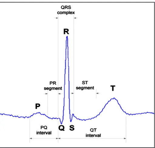 Fig. 1: ECG Waveform
