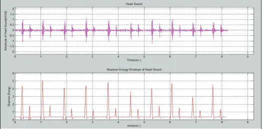 Fig. 3: Envelopes of Heart Sounds Signal Under Different Formula; (a) 2-order, (b) 3-order, (c) 4-order