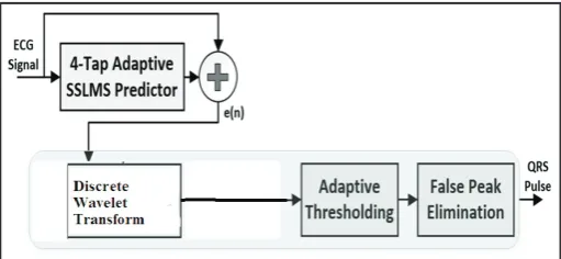 Fig. 1: QRS Blonding Wall Diagram