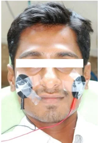 Fig 4 - Intraoral application of TENS using pen electrode 