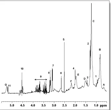 Figure 1.4 CaEDTA doublet; multiplet; acquired at 47. Proton NMR spectrum of human blood serum