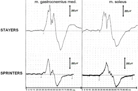 Table 1. Parameter of lower extremity MEP under stimulation of various nervous system structures in regular persons (n=10), Mean ± Standard Deviation