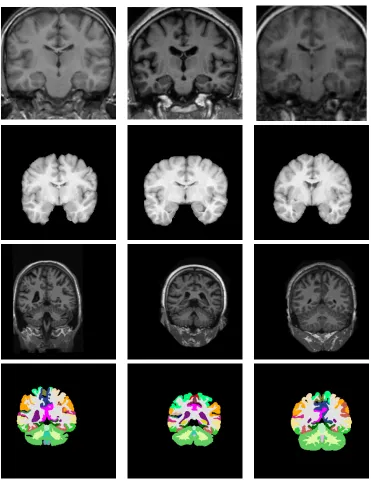 Figure 1.1: 2D slice examples of the MR images for brain anatomical segmentation.1st row, 2nd row, and 3rd row are the intensity images from three datasets; the lastrow shows the corresponding label images of the 3rd row.