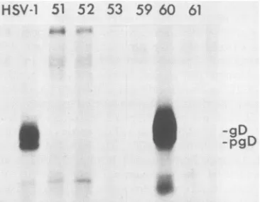 FIG.1.infectedandingpSV2HISgDVerousingwithHSV-1 Expression of HSV-1 gD in Vero cell transformants with HSV-2
