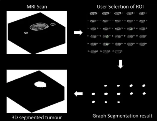Fig. 1: Illustration of different processes of the proposed method. Top left: 3D MRI Image