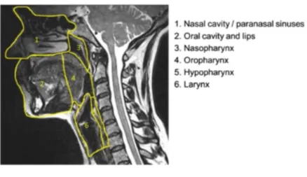 Figure 18 Spaces in head and neck – cross sectional CT image 