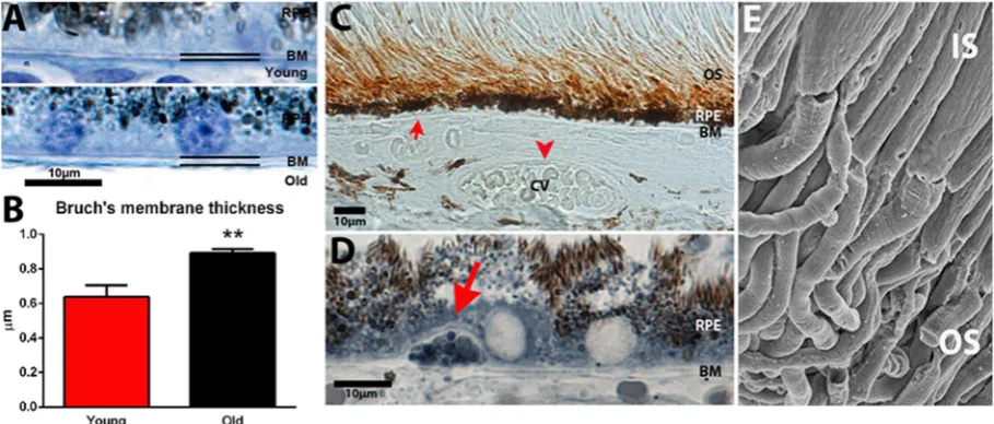 Figure 7. Age related changes in primate outer retina. There were age related changes in association with Bruch’s membrane (BM)