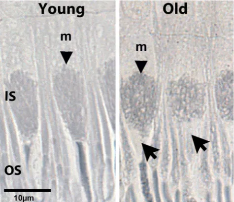 Figure 6. Age related changes in primate mitochondrial alignment. Retinae from young and old primates were osmicated, embedded in plastic, sectioned and stained with Sudan Black B