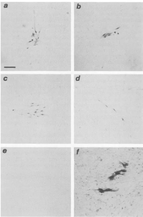 FIG. 5.fectedinfectionbackground.pp6Ov-srcafterpASrcneolBar,supernatant Alkaline phosphatase-immunostained foci of virus-in- CEF expressing pp6-src (dark cells) in an uninfected CEF Panels: representative foci of cells 3 to 4 days after with virus derived 
