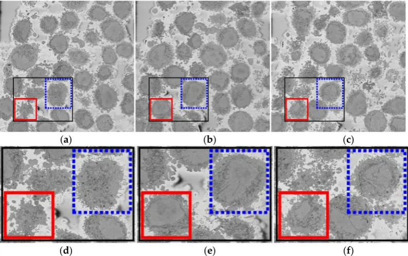 Figure 1.Figure 1. Three representative slices of a three-dimensional (3D) image stack acquired by Serial Block Face Scanning Electron Microscope (SBF SEM) containing numerous HeLa cells