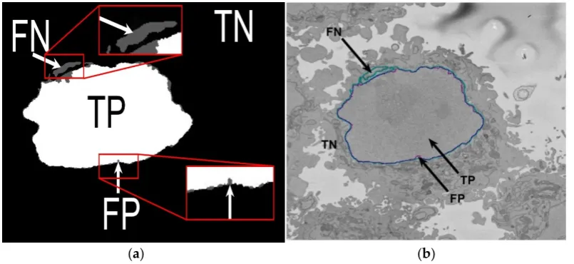 Figure 5.Figure 5. Illustration of the pixel-based metrics. (a) True Positives (TP, nuclear pixels segmented as nucleus), true negatives (TN, background pixels segmented as background), false positives (FP, background pixels segmented as nucleus), and fals