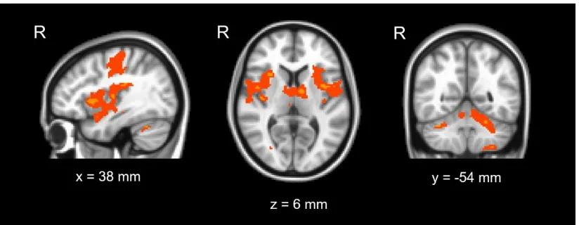 Figure 5: - Healthy controls – average brain activation in response to mild pain 