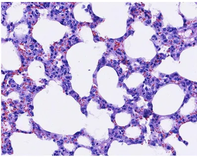Figure 6. A reduction in alveolar wall thickening, al-veolar destruction and interstitial inflammatory cell infiltration in the lung tissue of rats in the simvastatin group (HE staining ×200).