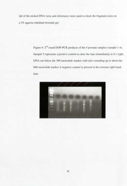 Figure 4: 2"^ round DOP-PCR products of the 4 prostate samples (sample 1-4). 