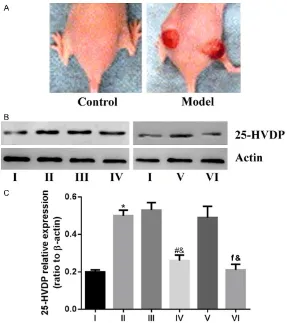 Figure 6. Western blot results for urea 25-hydroxyl vitamin D binding protein in liver cancer mice
