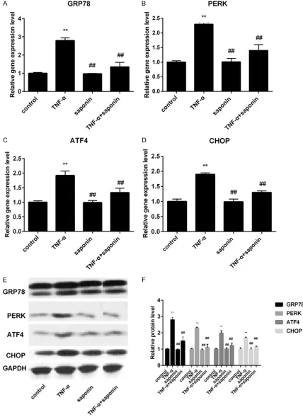 Figure 3. Effect of Asperosaponin VI on the activation of PERK pathway. A. Quantitative real-time PCR was used to detect GRP-78; B