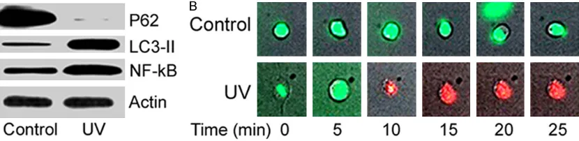 Figure 1. UV irradiation led to autophagy and NF-κB activation of HXO-RB44 cells. A. Western blot for cell autophagy; B