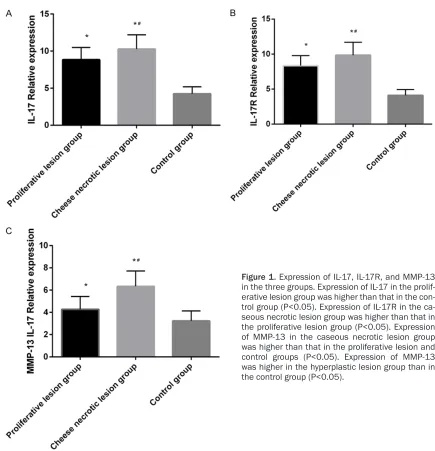 Figure 1. Expression of IL-17, IL-17R, and MMP-13 in the three groups. Expression of IL-17 in the prolif-erative lesion group was higher than that in the con-trol group (P<0.05)