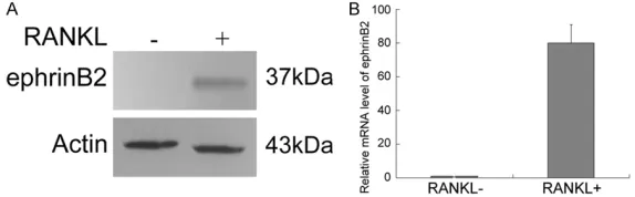 Figure 2. The expression of Par3 during RANKL-induced osteoclast differ-entiation of RAW264.7 cells