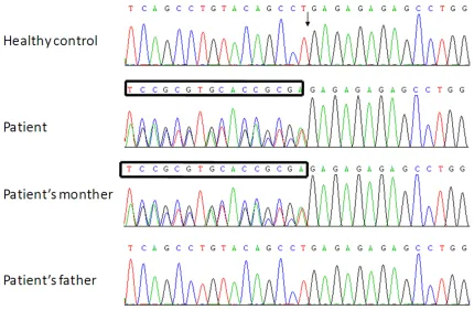 Figure 2. Genomic DNA analysis of AGXT gene.The molecular basis of PH1 was examined by analyzing the entire coding sequence of AGXT