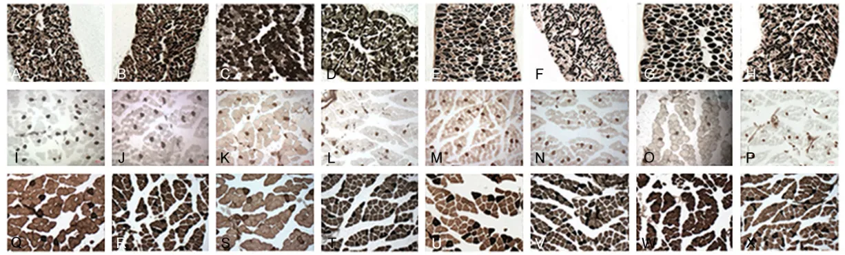 Figure 1. ATPase staining of diaphragm (A-H) and soleus (Q-X) at pH 10.4 and extensor digitorumlongus (I-P) at pH 4.4 from control 4 weeks group (A, I, Q), diabetic 4 weeks group (B, J, R), control 8 weeks group (C, K, S), diabetic 8 weeks group (D, L, T),
