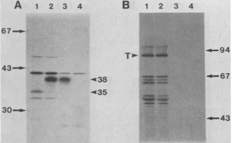 FIG.2.andfordiatelyvitroSAl1andmicrosomalpresenceimmunoprecipitatesglycosylatedSV40-infectedsolubilizationsamplespolyacrylamidepositionsautoradiogramcytoplasmicundergel.samples.precipitation,Molecular Protease protection assay for in vitro translocation of