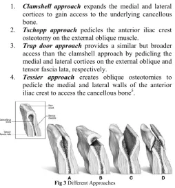 Fig 3 Different Approaches 