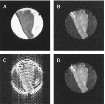 Figure 1. Effect of raw data inconsistency on reconstruction of reduced encoding diffusion-weighted images