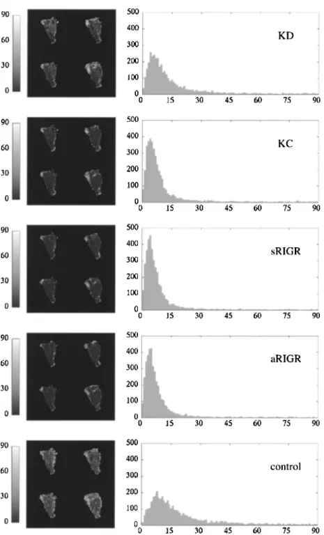 Figure 3. Deviation angle maps and histograms of myocardial fiber orientations obtained by reduced encoding and the control experiments