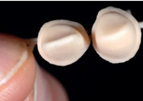Fig. 1. 3D printed teeth and data from an intra oral scanner  