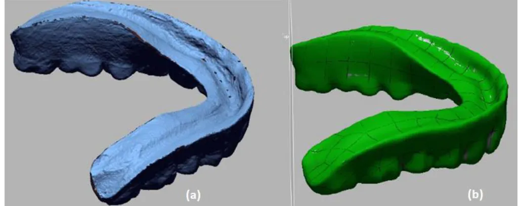Fig. 4. Post-processing phase of a denture scanned data (a) cloud point (b) polygon phase (c) color region 