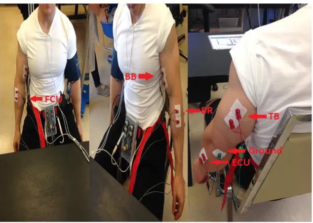 Figure 2: EMG Electrode Placement of electrodes on the non-dominant arm. 