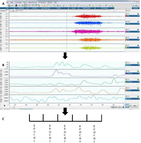 Figure 3: EMG data analysis protocol for extracting surface EMG data and binning of the data for analysis