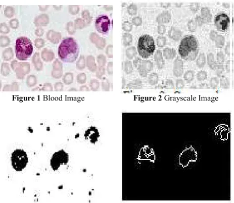 Figure 1    Blood Image                        Figure 2 Grayscale Image 