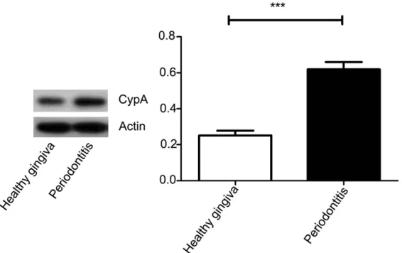 Figure 1. Expression and distribution of CypA in human inflamed and healthy gingiva. The positive staining (red arrows) was distributed in the gingival epi-thelium of the healthy gingiva