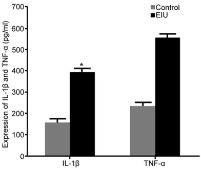 Figure 6. The impacts of EIU on VEGF expression in Muller cells. A. Real-time PCR detection of VEGF mRNA expres-sion; B