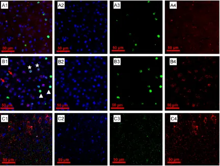 Figure 3. The influence of different times digested with proteinase K to the results of double labeling for c-fos protein (green) and mRNA (red) in mouse auditory cortex