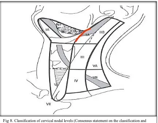 Fig 8. Classification of cervical nodal levels (Consensus statement on the classification and terminology of neck dissection
