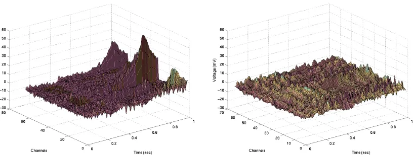 Figure 2.1: EEG patterns of an alcoholic and a control subject