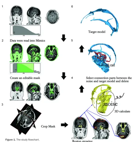 Table 1. The operating parameters of sinuses and cerebral veins