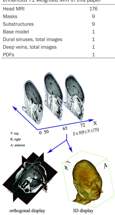 Table 2. List of structures based on contrast-enhanced T1 weighted MRI in this paper