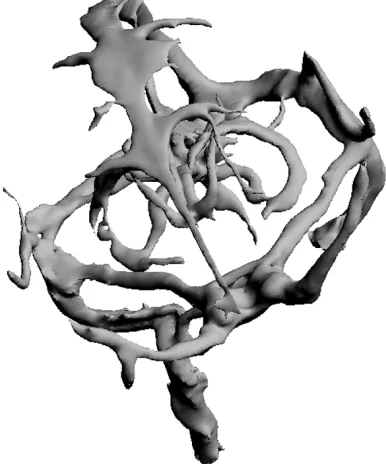 Figure 9. The comparison of dural sinus atlas constructed by different meth-ods.