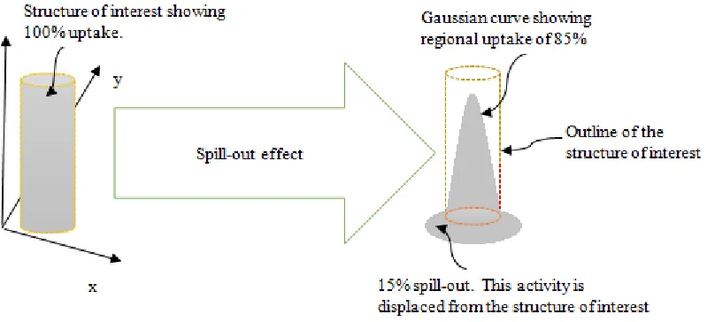 Fig. 1. Spill-out results in “loss” of activity from the organ or structure of interest hence apparent decrease in activity in the structure  